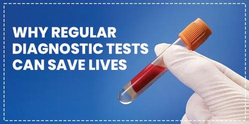 Why Regular Diagnostic Tests Can Save Lives