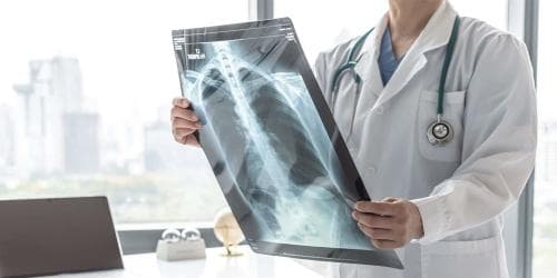 X-Ray