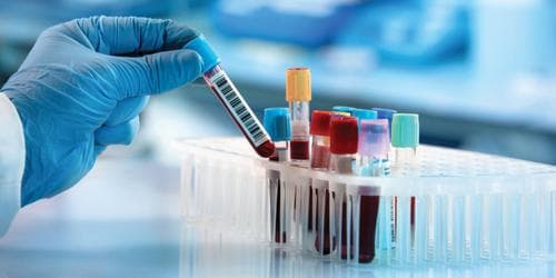 Laboratory (LAB)