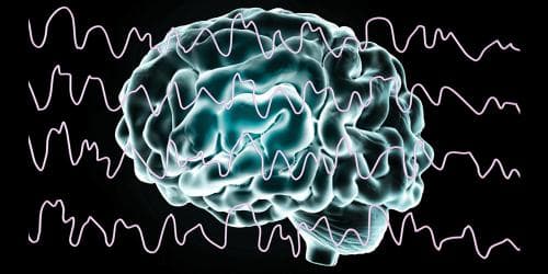 EEG (Electroencephalogram)