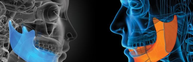 Maxillofacial Surgery